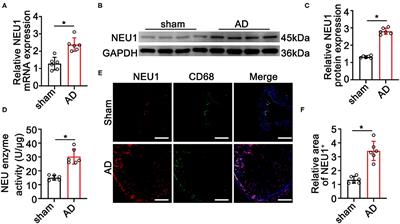 Neuraminidase 1 Exacerbating Aortic Dissection by Governing a Pro-Inflammatory Program in Macrophages